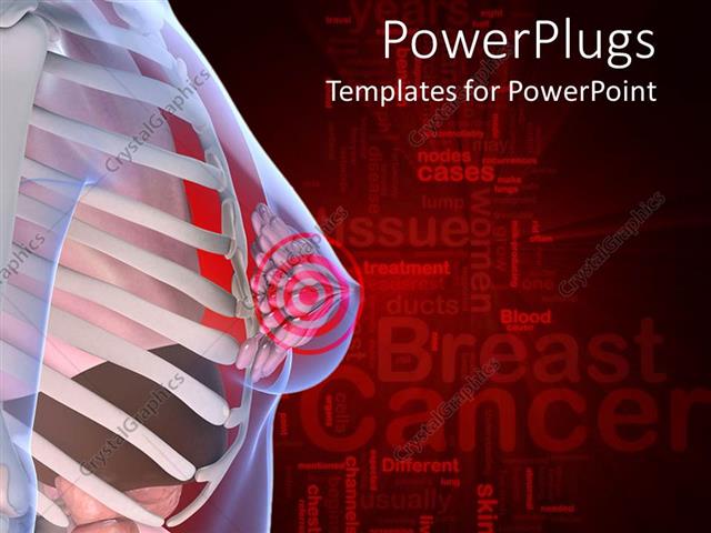 breast cancer powerpoint