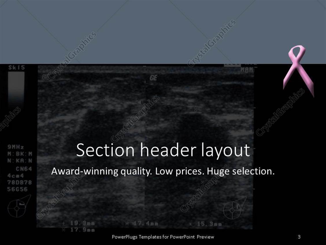 powerpoint template for award ceremony choice image - powerpoint powerpoint template for award ceremony choice image - powerpoint, Presentation templates
